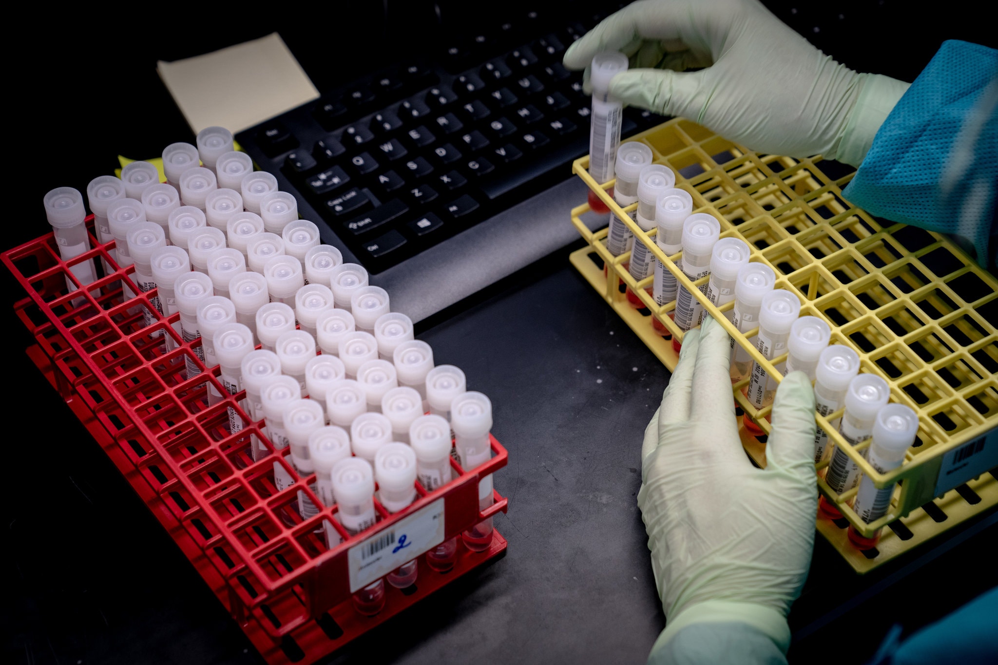 RT-PCR and Amplification